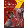 ATEROMA V14 N2